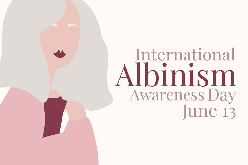 International Albinism Awareness Day 2021